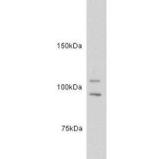 Anti-c-kit antibody