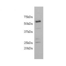 Anti-CD4 antibody