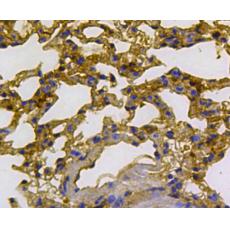 Anti-Cytokeratin 18 antibody