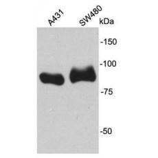 Anti-β-Catenin antibody