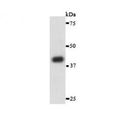 Anti-α-Actin (cardiac actin) antibody