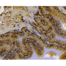 Anti-Cytokeratin 17 antibody