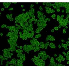 Anti-14-3-3 beta/alpha antibody