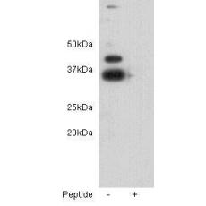 Anti-ZFP-42/REX-1 antibody