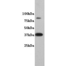 Anti-DPPA2 antibody