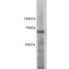 Anti-ESR1 antibody
