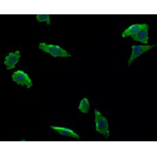 Anti-TIE-1 antibody