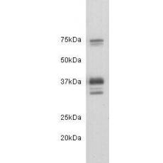 Anti-CD24 antibody