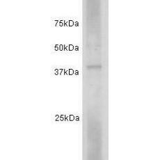 Anti-CD24 antibody