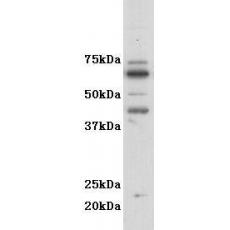 Anti-GM-CSF-R-alpha (CD116) antibody