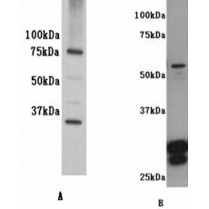 Anti-IL-7R-alpha antibody