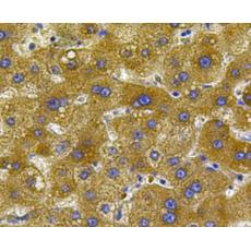 Anti-Noggin antibody