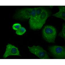 Anti-CD3 zeta antibody