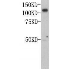 Anti-MCAM(CD146) antibody