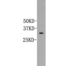 Anti-Osteopontin antibody