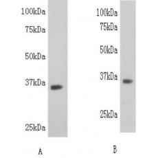 Anti-LDH-B antibody