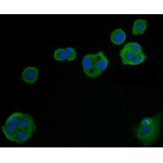 Anti-Carcino Embryonic Antigen CEA antibody