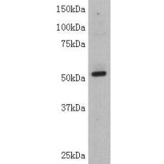 Anti-TdT antibody