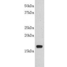 Anti-TdT antibody