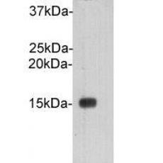 Anti-Cystatin C antibody