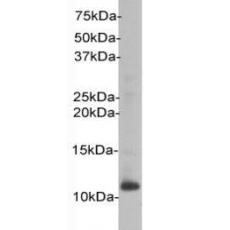 Anti-Beta-2 Microglobulin antibody