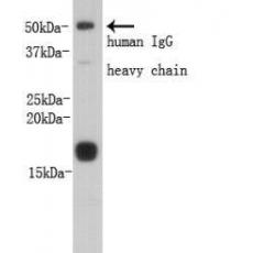 Anti-Prealbumin PA antibody