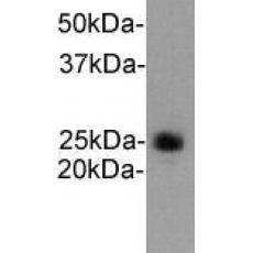 Anti-Ly-6G antibody