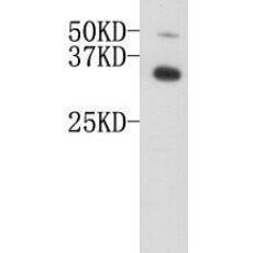 Anti-ApoE antibody