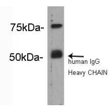 Anti-Complement C4(β chain) antibody