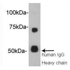 Anti-Vitamin K-dependent protein S antibody