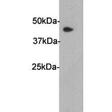 Anti-PAI-3 antibody