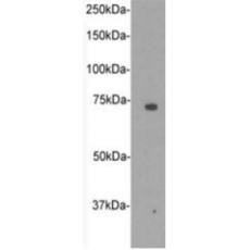 Anti-CD105 antibody