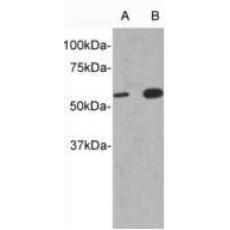 Anti-IL13Ra1 antibody
