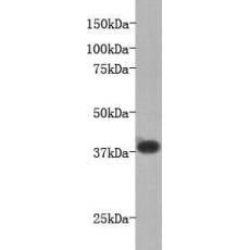 Anti-LPA receptor 1 antibody