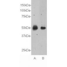 Anti-Relaxin 3 receptor 1 antibody