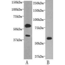 Anti-TMEM57 antibody