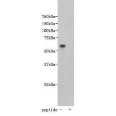 Anti-TMEM132E antibody