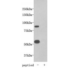 Anti-Transmembrane protein 2 antibody