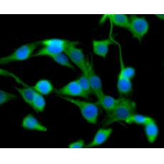 Anti-Transmembrane protein 132A antibody