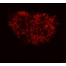 Anti-FAT tumor suppressor homolog 4 antibody