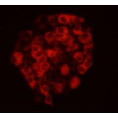 Anti-Cadherin EGF LAG seven-pass G-type receptor 2 antibody