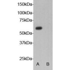 Anti-Autoimmune regulator antibody