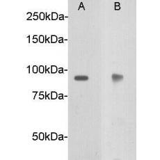 Anti-Netrin receptor DCC antibody