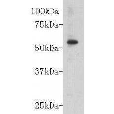 Anti-CD147 antibody