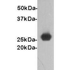 Anti-GST antibody