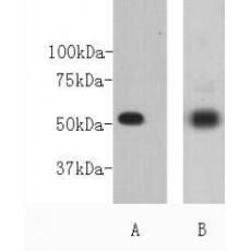 Anti-CD271 antibody