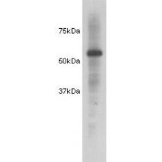Anti-HSP60 antibody