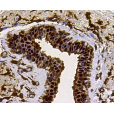 Anti-LDHA antibody
