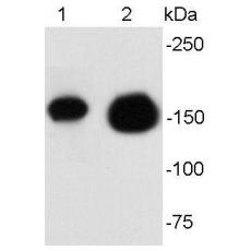 Anti-HER2 / ErbB2 antibody