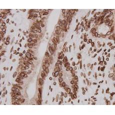 Anti-LMNB2 antibody